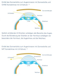 Zeigt den UV-Schutz durch eine Tageslinsen.